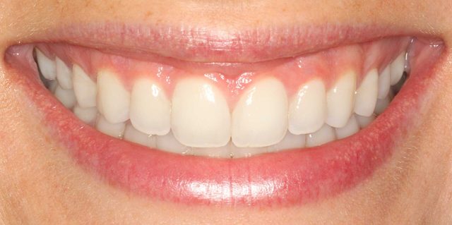 smile-05-ps